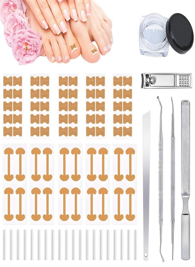 IMOLL Ingrown Toenail Corrector Set with Correction Strips,Professional Ingrown Toenails Pedicure Tool Set, Toenail Correction Strips & Ingrown Toenail Corrector,Ingrown Nail Tool for Women Man - Image 1